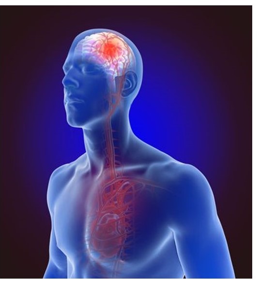 Le patologie cardiocerebrovascolari nello studio del MMG