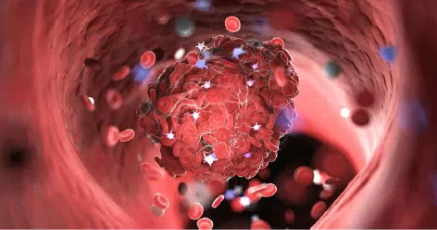 Opportunità E Strategie Terapeutiche Per Un Uso Appropriato Degli Anticoagulanti Iniettivi In Ambito Territoriale